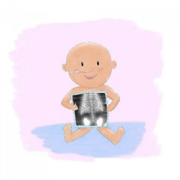 baby holding xray scan baby holding xray scan